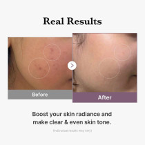 Medicube-Age-R Glutathione Glow Toner, 140Ml