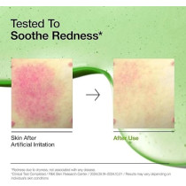 Anua Azelaic Acid 10 Hyaluron Redness Soothing Serum, Facial Serum For Sensitive Skin, Hyaluronic Acid, Niacinamide, Spot Care, Natural Color, Vegan, Korean Skincare, 30Ml