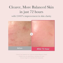 Medicube Txa+Niacinamide 15Percentage Glow Facial Seurm For After Spot Care, All-In-One Daily Korean Skincare, Uneven Skin Tone, Texture, And Hydration Care, High-Potency Tranexamic Acid 5Percentage, 30 Ml