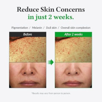 Dr.Althea Gentle Vitamin C Serum, Benefits Skin Tone And Pigmentation, Gentle On Skin For Even Skin Tone, Korean Vegan Skincare For All Skin Types (Gentle Vitamin C)