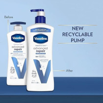 Vaseline Intensive Care Unscented Advanced Repair Body Lotion, Ultra-Hydrating With Lipids For Extremely Dry Skin, 600 Ml, Pack Of 3
