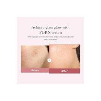 Medicube Salmon Dna Pdrn Pink Hyaluronic Moisturizing Cream, 50Ml/1.69 Fl.Oz