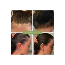 Mielle Organics Rosemary Mint Strengthening Set 5, Rosemary Hair Oil, Shampoo, Hair Mask, Derma Ruller And Scrubber