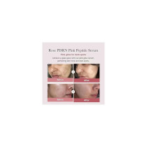 Medicube Pdrn Pink Peptide Serum, 30Ml