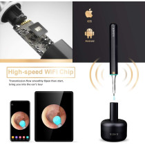 BEBIRD X17 Pro Ear Wax Removal Camera Endoscope, All Aluminum Body H-Speed WiFi 6 Axis Intelligent Gyroscope Safe Professional 1080p Smart Visual Ear Cleaner with Camera for Kid Adult Pet