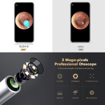 BEBIRD X17 Pro Ear Wax Removal Camera Endoscope, All Aluminum Body H-Speed WiFi 6 Axis Intelligent Gyroscope Safe Professional 1080p Smart Visual Ear Cleaner with Camera for Kid Adult Pet