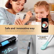 BEBIRD X17 Pro Ear Wax Removal Camera Endoscope, All Aluminum Body H-Speed WiFi 6 Axis Intelligent Gyroscope Safe Professional 1080p Smart Visual Ear Cleaner with Camera for Kid Adult Pet