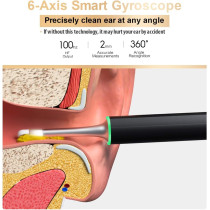 BEBIRD X17 Pro Ear Wax Removal Camera Endoscope, All Aluminum Body H-Speed WiFi 6 Axis Intelligent Gyroscope Safe Professional 1080p Smart Visual Ear Cleaner with Camera for Kid Adult Pet