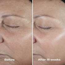 Clinique Smart Clinical Repair Wrinkle Correcting Serum Face Serum, 50ml