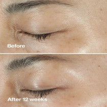 Clinique Smart Clinical Repair Wrinkle Correcting Serum Face Serum, 50ml