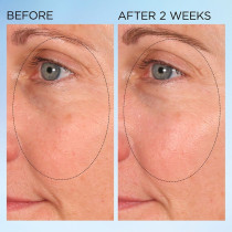 Elizabeth Arden Visible Brightening Clearly Radiant Spot Correcting Capsules Face Serum, 60 Ct