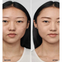 Clinique Even Better Clinical Serum Foundation With Spf 20 Foundation, 28 Ivory