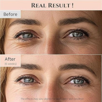 Beauty of Joseon Korean Eye Serum, 30ml