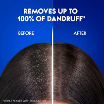 Head And Shoulders Menthol Refresh Anti-Dandruff Shampoo For Itchy Scalp, Pack Of 2, 400 + 200 ml